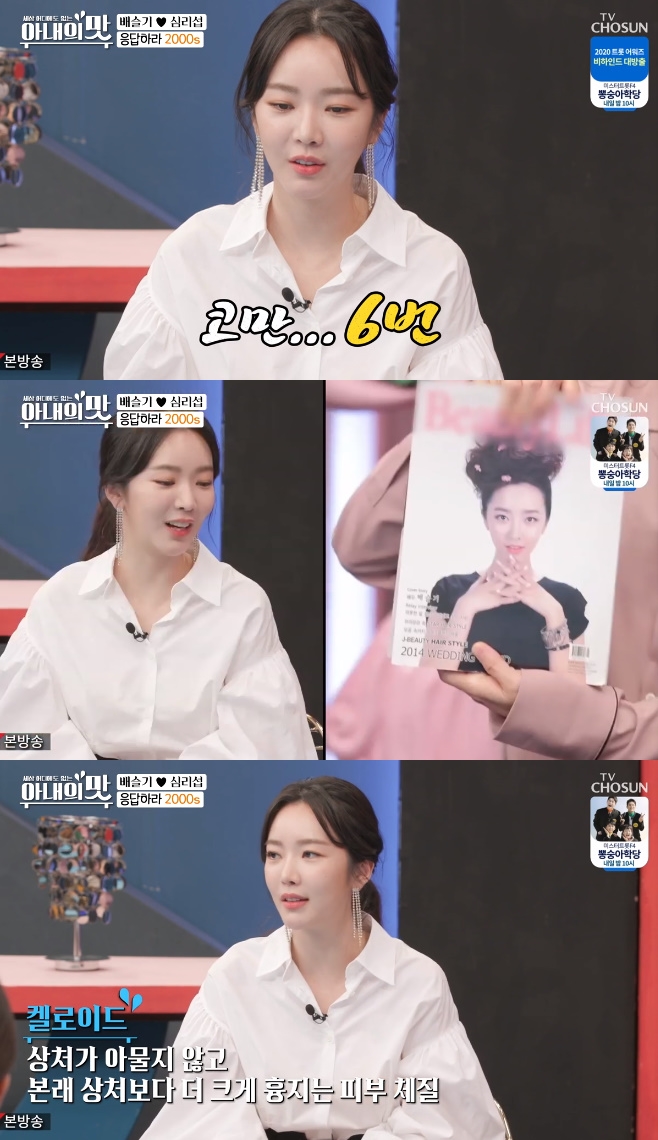 ¾Æ³»ÀÇ ¸À, ¹è½½±â