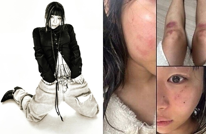 ƼºêÀ̵¥Àϸ® Æ÷Åä