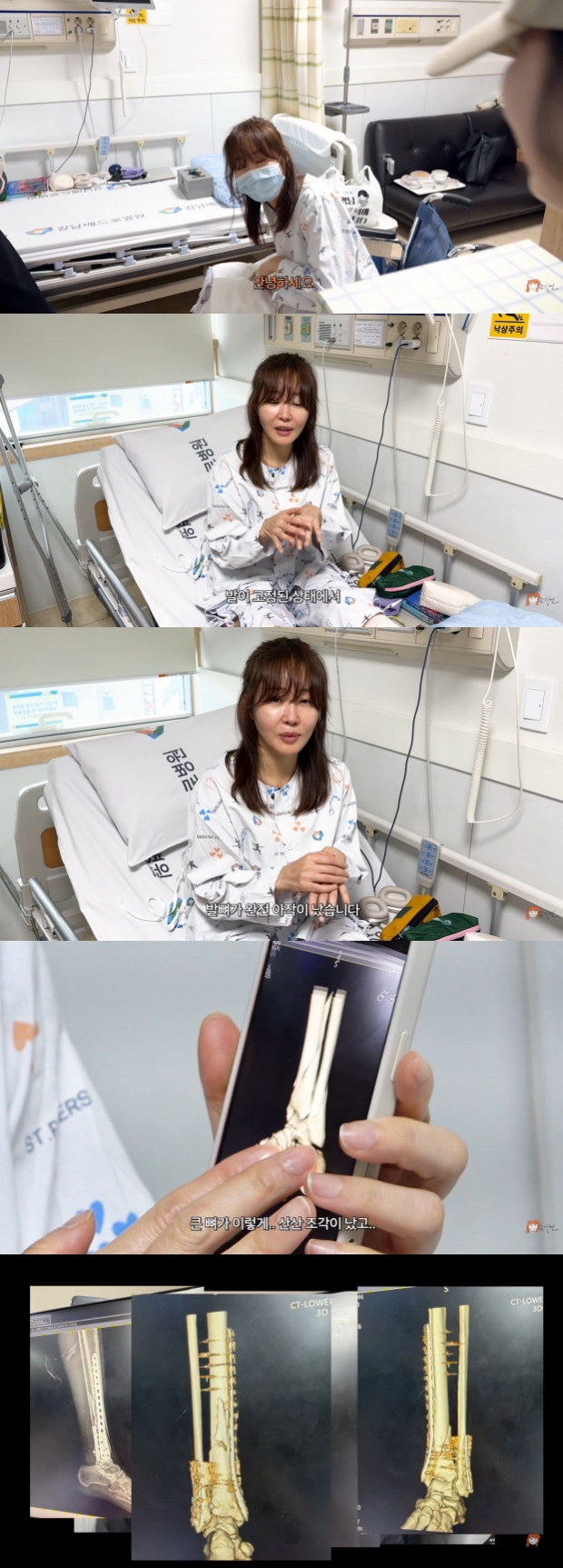 Ƽ���̵��ϸ� ����