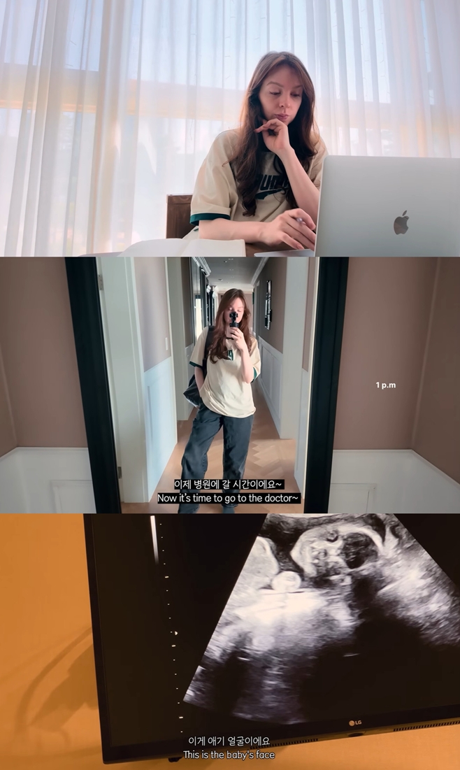 Àü Ã౸ ¼±¼ö ¹ÚÁÖÈ£ ¾Æ³» ¾È³ª